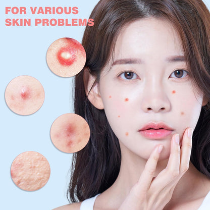 Pimple Patches for Face 207PCS, Hydrocolloid Acne Patches for Covering Zits and Blemishes, Cute Star Pimple Patches, Facial Skin Care Products.