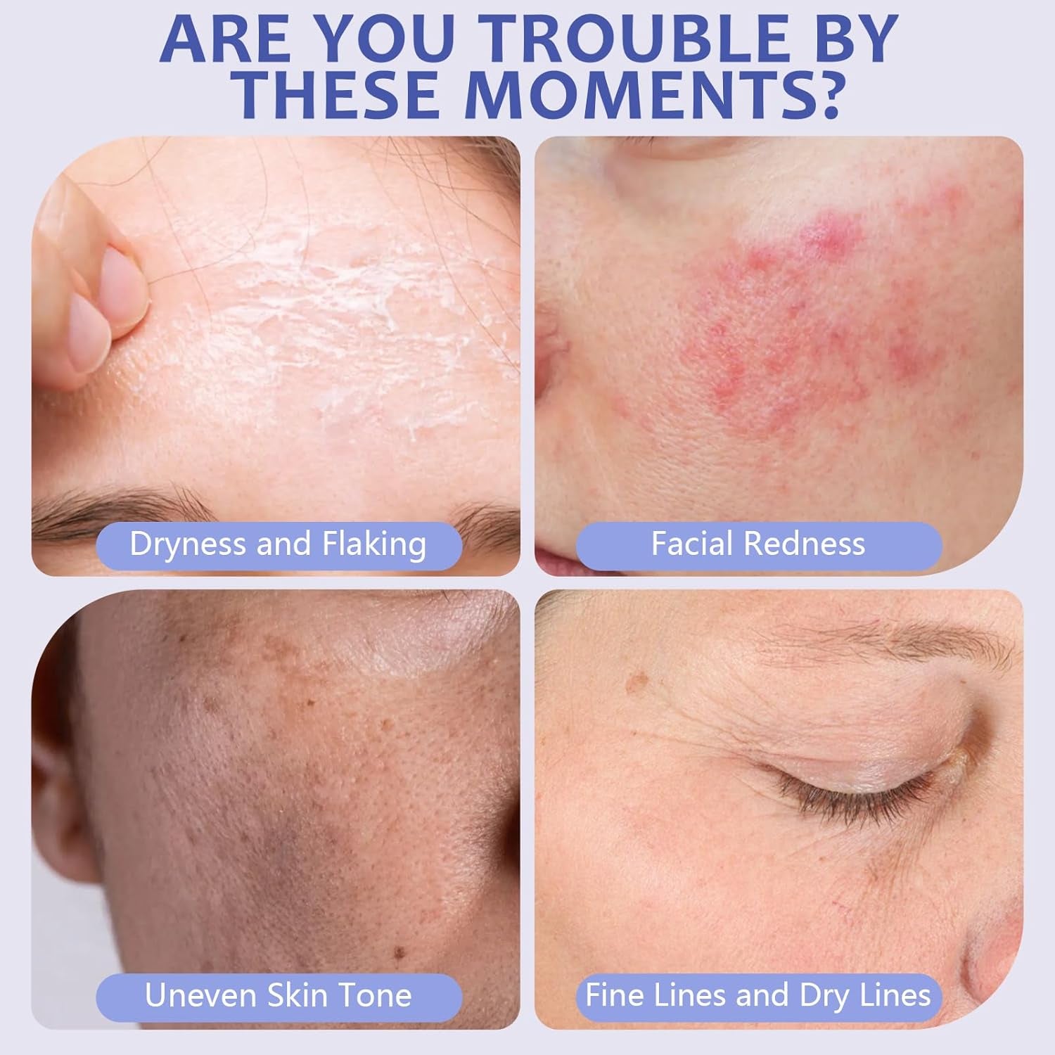 The Dewy Skin Cream Face Moisturizer Skin Care Face Cream Boost Water Gel Lightweight Oil-Free -Improve Skins Hydration 1.7 Fl Oz